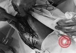 Image of operating a leg France, 1918, second 62 stock footage video 65675042404