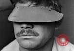 Image of eye injuries from gas attack during World War I France, 1918, second 1 stock footage video 65675042405