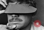 Image of eye injuries from gas attack during World War I France, 1918, second 3 stock footage video 65675042405