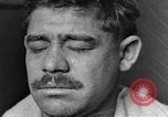 Image of eye injuries from gas attack during World War I France, 1918, second 6 stock footage video 65675042405