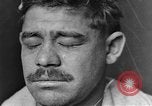 Image of eye injuries from gas attack during World War I France, 1918, second 7 stock footage video 65675042405