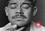 Image of eye injuries from gas attack during World War I France, 1918, second 9 stock footage video 65675042405