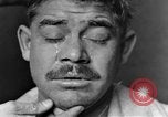 Image of eye injuries from gas attack during World War I France, 1918, second 13 stock footage video 65675042405