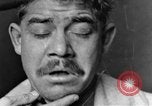Image of eye injuries from gas attack during World War I France, 1918, second 18 stock footage video 65675042405