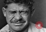 Image of eye injuries from gas attack during World War I France, 1918, second 21 stock footage video 65675042405