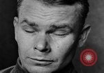 Image of eye injuries from gas attack during World War I France, 1918, second 25 stock footage video 65675042405