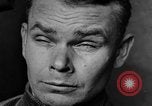 Image of eye injuries from gas attack during World War I France, 1918, second 26 stock footage video 65675042405
