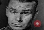 Image of eye injuries from gas attack during World War I France, 1918, second 28 stock footage video 65675042405