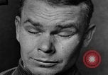 Image of eye injuries from gas attack during World War I France, 1918, second 29 stock footage video 65675042405