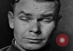 Image of eye injuries from gas attack during World War I France, 1918, second 30 stock footage video 65675042405