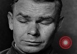 Image of eye injuries from gas attack during World War I France, 1918, second 31 stock footage video 65675042405