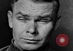 Image of eye injuries from gas attack during World War I France, 1918, second 32 stock footage video 65675042405