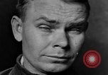 Image of eye injuries from gas attack during World War I France, 1918, second 33 stock footage video 65675042405