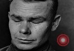 Image of eye injuries from gas attack during World War I France, 1918, second 34 stock footage video 65675042405