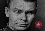 Image of eye injuries from gas attack during World War I France, 1918, second 35 stock footage video 65675042405