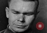 Image of eye injuries from gas attack during World War I France, 1918, second 36 stock footage video 65675042405