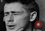 Image of eye injuries from gas attack during World War I France, 1918, second 40 stock footage video 65675042405