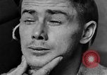 Image of eye injuries from gas attack during World War I France, 1918, second 42 stock footage video 65675042405