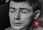 Image of eye injuries from gas attack during World War I France, 1918, second 43 stock footage video 65675042405