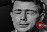 Image of eye injuries from gas attack during World War I France, 1918, second 44 stock footage video 65675042405