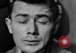 Image of eye injuries from gas attack during World War I France, 1918, second 45 stock footage video 65675042405