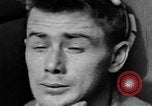 Image of eye injuries from gas attack during World War I France, 1918, second 46 stock footage video 65675042405