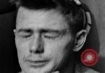 Image of eye injuries from gas attack during World War I France, 1918, second 47 stock footage video 65675042405