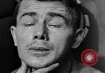 Image of eye injuries from gas attack during World War I France, 1918, second 48 stock footage video 65675042405