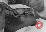 Standbild verletzte Soldaten Frankreich, 1918, aus Sekunde 12 historischem Filmmaterial Videoclip 65675042407