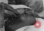 Standbild verletzte Soldaten Frankreich, 1918, aus Sekunde 14 historischem Filmmaterial Videoclip 65675042407