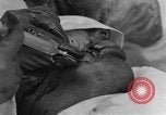 Standbild verletzte Soldaten Frankreich, 1918, aus Sekunde 23 historischem Filmmaterial Videoclip 65675042407
