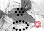 Standbild Die Abdominal- wunde Chirurgie auf Ersten Weltkrieg Soldat Frankreich, 1918, aus Sekunde 1 historischem Filmmaterial Videoclip 65675042421