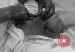 Standbild Die Abdominal- wunde Chirurgie auf Ersten Weltkrieg Soldat Frankreich, 1918, aus Sekunde 6 historischem Filmmaterial Videoclip 65675042421