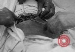 Standbild Die Abdominal- wunde Chirurgie auf Ersten Weltkrieg Soldat Frankreich, 1918, aus Sekunde 8 historischem Filmmaterial Videoclip 65675042421