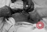 Standbild Die Abdominal- wunde Chirurgie auf Ersten Weltkrieg Soldat Frankreich, 1918, aus Sekunde 10 historischem Filmmaterial Videoclip 65675042421