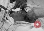Standbild Die Abdominal- wunde Chirurgie auf Ersten Weltkrieg Soldat Frankreich, 1918, aus Sekunde 11 historischem Filmmaterial Videoclip 65675042421