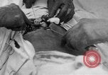 Standbild Die Abdominal- wunde Chirurgie auf Ersten Weltkrieg Soldat Frankreich, 1918, aus Sekunde 12 historischem Filmmaterial Videoclip 65675042421