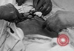 Standbild Die Abdominal- wunde Chirurgie auf Ersten Weltkrieg Soldat Frankreich, 1918, aus Sekunde 13 historischem Filmmaterial Videoclip 65675042421