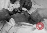Standbild Die Abdominal- wunde Chirurgie auf Ersten Weltkrieg Soldat Frankreich, 1918, aus Sekunde 14 historischem Filmmaterial Videoclip 65675042421