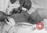 Standbild Die Abdominal- wunde Chirurgie auf Ersten Weltkrieg Soldat Frankreich, 1918, aus Sekunde 15 historischem Filmmaterial Videoclip 65675042421