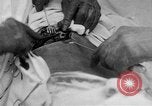 Standbild Die Abdominal- wunde Chirurgie auf Ersten Weltkrieg Soldat Frankreich, 1918, aus Sekunde 16 historischem Filmmaterial Videoclip 65675042421