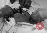 Standbild Die Abdominal- wunde Chirurgie auf Ersten Weltkrieg Soldat Frankreich, 1918, aus Sekunde 17 historischem Filmmaterial Videoclip 65675042421