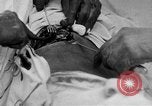 Standbild Die Abdominal- wunde Chirurgie auf Ersten Weltkrieg Soldat Frankreich, 1918, aus Sekunde 18 historischem Filmmaterial Videoclip 65675042421