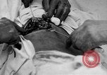Standbild Die Abdominal- wunde Chirurgie auf Ersten Weltkrieg Soldat Frankreich, 1918, aus Sekunde 20 historischem Filmmaterial Videoclip 65675042421