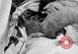Standbild Die Abdominal- wunde Chirurgie auf Ersten Weltkrieg Soldat Frankreich, 1918, aus Sekunde 22 historischem Filmmaterial Videoclip 65675042421