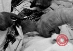 Standbild Die Abdominal- wunde Chirurgie auf Ersten Weltkrieg Soldat Frankreich, 1918, aus Sekunde 23 historischem Filmmaterial Videoclip 65675042421