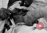 Standbild Die Abdominal- wunde Chirurgie auf Ersten Weltkrieg Soldat Frankreich, 1918, aus Sekunde 24 historischem Filmmaterial Videoclip 65675042421