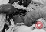 Standbild Die Abdominal- wunde Chirurgie auf Ersten Weltkrieg Soldat Frankreich, 1918, aus Sekunde 26 historischem Filmmaterial Videoclip 65675042421