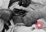 Standbild Die Abdominal- wunde Chirurgie auf Ersten Weltkrieg Soldat Frankreich, 1918, aus Sekunde 27 historischem Filmmaterial Videoclip 65675042421