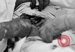 Standbild Die Abdominal- wunde Chirurgie auf Ersten Weltkrieg Soldat Frankreich, 1918, aus Sekunde 29 historischem Filmmaterial Videoclip 65675042421